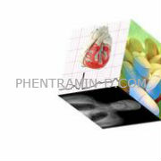 are there Phentramin-D side effects